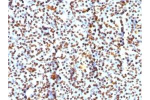 Immunohistochemistry (Formalin-fixed Paraffin-embedded Sections) (IHC (fp)) image for anti-Histone antibody (ABIN3024807)