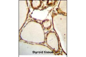 HJURP Antibody (C-term) (ABIN657329 and ABIN2846399) immunohistochemistry analysis in formalin fixed and paraffin embedded human thyroid tissue followed by peroxidase conjugation of the secondary antibody and DAB staining. (HJURP anticorps  (C-Term))