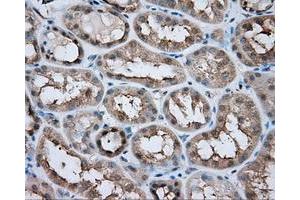 Immunohistochemical staining of paraffin-embedded liver tissue using anti-LIPG mouse monoclonal antibody. (LIPG anticorps)
