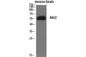 Western Blot (WB) analysis of specific cells using Akt2 Polyclonal Antibody. (AKT2 anticorps  (Ser138))