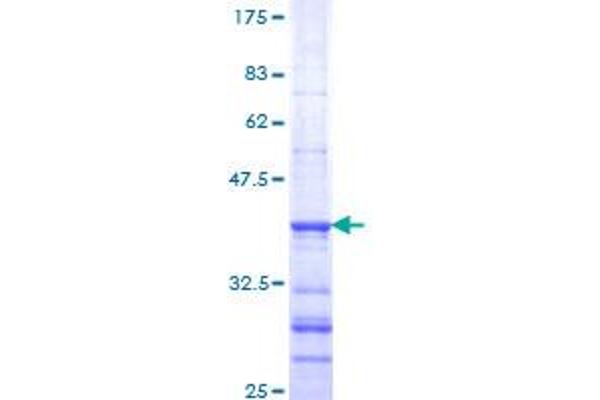 SOD2 Protein (AA 1-110) (GST tag)