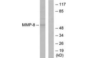 Western Blotting (WB) image for anti-Matrix Metallopeptidase 8 (Neutrophil Collagenase) (MMP8) (AA 418-467) antibody (ABIN2889234) (MMP8 anticorps  (AA 418-467))