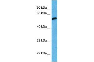 Host:  Mouse  Target Name:  DES  Sample Tissue:  Mouse Testis  Antibody Dilution:  1ug/ml (Desmin anticorps  (Middle Region))
