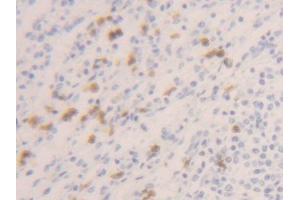 DAB staining on IHC-P; Samples: Human Spleen Tissue (Caspase 1 anticorps  (AA 120-297))