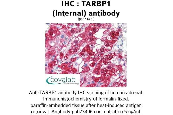 TARBP1 anticorps  (Internal Region)