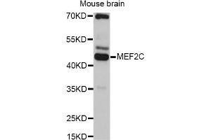 Western blot analysis of extracts of mouse brain, using MEF2C antibody. (MEF2C anticorps)