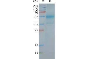 Human C-Nanodisc, Flag Tag on SDS-PAGE (CXCR4 Protéine)