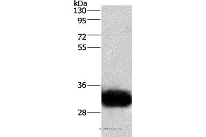 Western blot analysis of Human fetal brain tissue, using GPM6A Polyclonal Antibody at dilution of 1:950 (GPM6A anticorps)