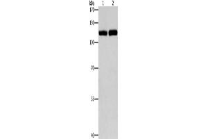 Western Blotting (WB) image for anti-Toll-Like Receptor 3 (TLR3) antibody (ABIN2421026) (TLR3 anticorps)