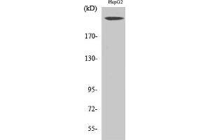 Western Blot analysis of various cells using Neurofibromin Polyclonal Antibody. (Neurofibromin 1 anticorps  (AA 1520-1600))