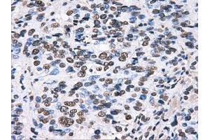 Immunohistochemical staining of paraffin-embedded pancreas tissue using anti-HDAC10mouse monoclonal antibody. (HDAC10 anticorps)