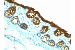 Immunohistochemistry (Formalin-fixed Paraffin-embedded Sections) (IHC (fp)) image for anti-Keratin 19 (KRT19) antibody (ABIN3025844)