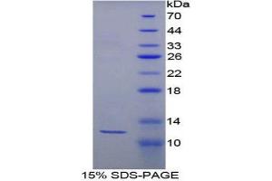 SDS-PAGE (SDS) image for Glycophorin A (GYPA) (AA 20-91) protein (His tag) (ABIN1879151) (CD235a/GYPA Protein (AA 20-91) (His tag))