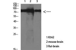 Western Blot analysis of various cells using Antibody diluted at 1:1000. (tau anticorps)