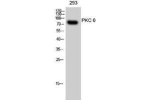 Western Blotting (WB) image for anti-Protein Kinase C, theta (PRKCQ) (Thr319) antibody (ABIN3176929) (PKC theta anticorps  (Thr319))