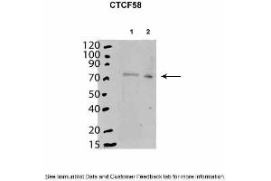 Mouse stem cells expressed in cytoplasm and nucleoplasm. (CTCF anticorps  (C-Term))