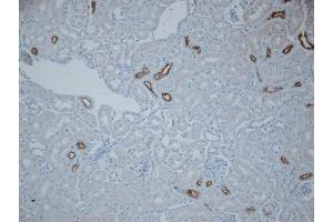 Immunohistochemistry (IHC) image for anti-Solute Carrier Family 12 (Sodium/Chloride Transporters), Member 3 (SLC12A3) (AA 74-95) antibody (ABIN863201)