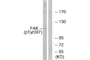 Western blot analysis of extracts from 293cells, treated with EGF (200ng/ml, 30mins), using FAK (Phospho-Tyr397) antibody. (FAK anticorps  (pTyr397))