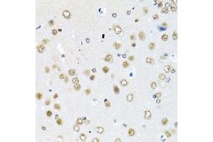 Immunohistochemistry of paraffin-embedded rat brain using RAB3IP antibody. (RAB3IP anticorps  (AA 1-150))