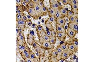 Immunohistochemical analysis of CCR5 staining in human liver formalin fixed paraffin embedded tissue section. (CCR5 anticorps)