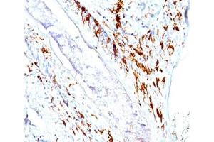 IHC testing of human skin stained with CD1a antibody cocktail (O10 + C1A/711). (CD1a anticorps)