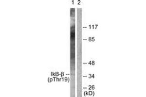 Western blot analysis of extracts from 293 cells treated with TNF-a 20ng/ml 30', using IkappaB-beta (Phospho-Thr19) Antibody. (NFKBIB anticorps  (pThr19))