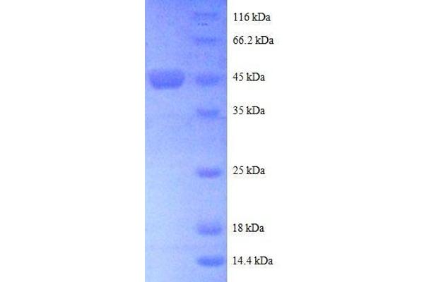 ARL2 Protein (AA 19-184, partial) (GST tag)