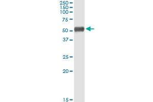 Immunoprecipitation of ALDH1A1 transfected lysate using rabbit polyclonal anti-ALDH1A1 and Protein A Magnetic Bead (ALDH1A1 (Humain) IP-WB Antibody Pair)