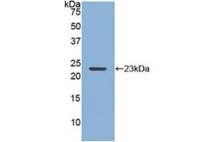Detection of Recombinant MMP12, Rabbit using Polyclonal Antibody to Matrix Metalloproteinase 12 (MMP12) (MMP12 anticorps  (AA 286-464))