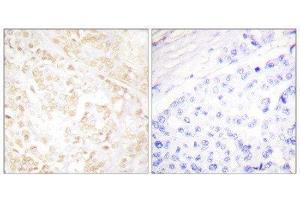 Immunohistochemistry (IHC) image for anti-X-Ray Repair Complementing Defective Repair in Chinese Hamster Cells 6 (XRCC6) (C-Term) antibody (ABIN1848904) (XRCC6 anticorps  (C-Term))