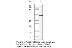 Image no. 2 for anti-Vimentin (VIM) antibody (ABIN232124) (Vimentin anticorps)