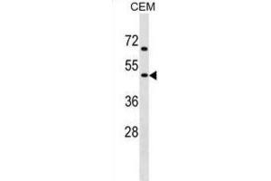 Western Blotting (WB) image for anti-Cholinergic Receptor, Nicotinic, gamma (CHRNG) antibody (ABIN2999214) (CHRNG anticorps)