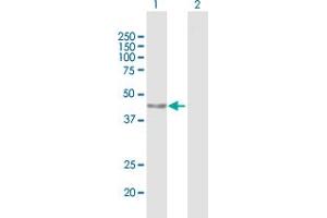 Western Blot analysis of PARP15 expression in transfected 293T cell line by PARP15 MaxPab polyclonal antibody. (PARP15 anticorps  (AA 1-444))