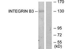 Western blot analysis of extracts from HepG2 cells, using Integrin beta3 (Ab-773) Antibody. (Integrin beta 3 anticorps  (AA 731-780))