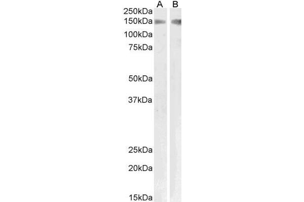 PLA2R1 anticorps  (Internal Region)