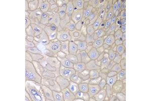 Immunohistochemistry of paraffin-embedded human esophagus using ANXA1 antibody (ABIN5970468) at dilution of 1/100 (40x lens). (Annexin a1 anticorps)