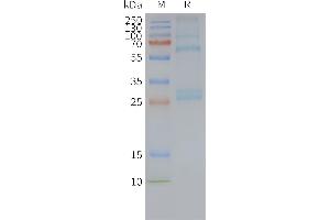 Human AD-Nanodisc, Flag Tag on SDS-PAGE (ADGRG1 Protéine)