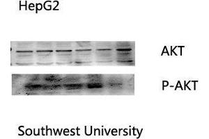 Western Blot (WB) analysis: Please contact us for more details. (AKT1 anticorps  (Internal Region))