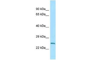 WB Suggested Anti-Rab5a Antibody Titration: 1. (RAB5 anticorps  (C-Term))
