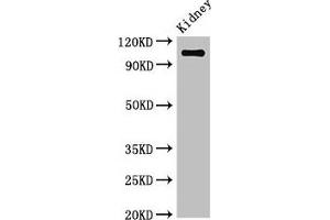 Western Blot Positive WB detected in: Mouse kidney tissue All lanes: ANPEP antibody at 3. (CD13 anticorps  (AA 34-219))