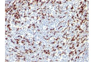 Formalin-fixed, paraffin-embedded human Tonsil stained with PD1 (CD279) Rabbit Polyclonal Antibody. (PD-1 anticorps)