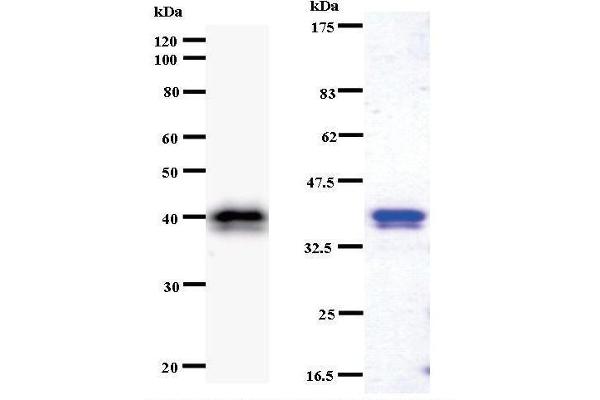 CHD1L anticorps