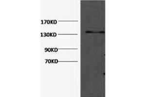Western Blotting (WB) image for anti-Collagen, Type III, alpha 1 (COL3A1) antibody (ABIN5959045) (COL3A1 anticorps)