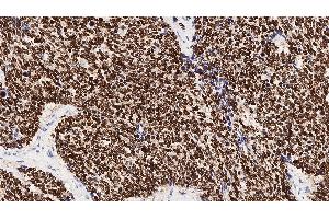 Immunohistochemistry (IHC) image for anti-NK2 Homeobox 1 (NKX2-1) (N-Term) antibody (ABIN7538942) (NKX2-1 anticorps  (N-Term))