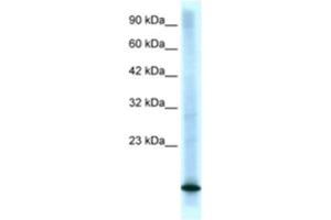 Western Blotting (WB) image for anti-Cyclin-Dependent Kinase Inhibitor 2B (p15, Inhibits CDK4) (CDKN2B) antibody (ABIN2463682) (CDKN2B anticorps)
