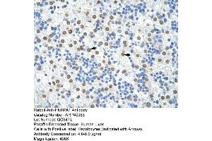 Rabbit Anti-HNRPA1 Antibody  Paraffin Embedded Tissue: Human Liver Cellular Data: Hepatocytes Antibody Concentration: 4. (HNRNPA1 anticorps  (N-Term))