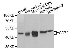 Western blot analysis of extracts of various cell lines, using CD72 antibody (ABIN6003638) at 1/1000 dilution. (CD72 anticorps)