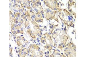 Immunohistochemistry of paraffin-embedded Human stomach using Lyn Polyclonal Antibody at dilution of 1:100 (40x lens). (LYN anticorps)