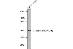 Western blot analysis of extracts of Mouse serum, using C-Reactive Protein (C-Reactive Protein (CRP)) antibody (ABIN7265972) at 1:1000 dilution. (CRP anticorps)