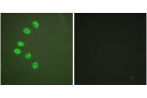 Immunofluorescence (IF) image for anti-Progesterone Receptor (PGR) (AA 261-310) antibody (ABIN2888697) (Progesterone Receptor anticorps  (AA 261-310))